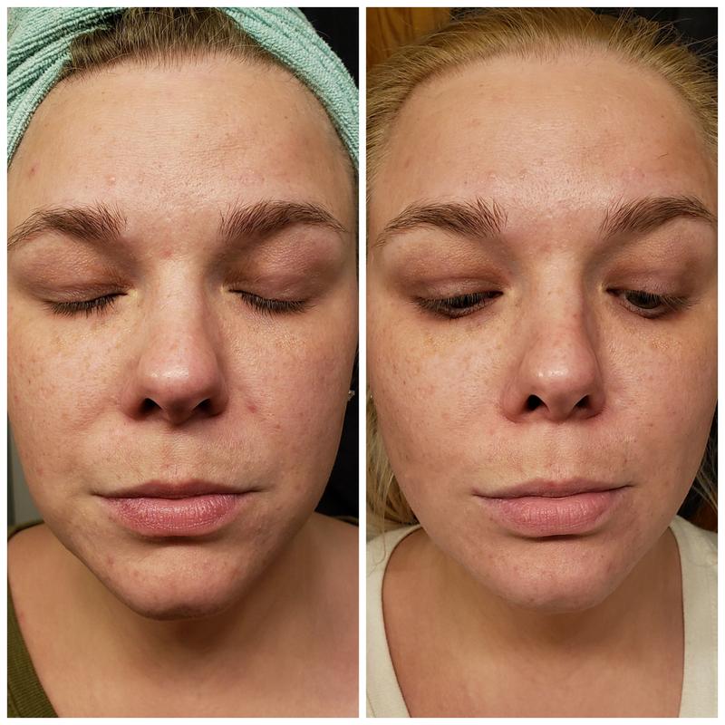 review photo