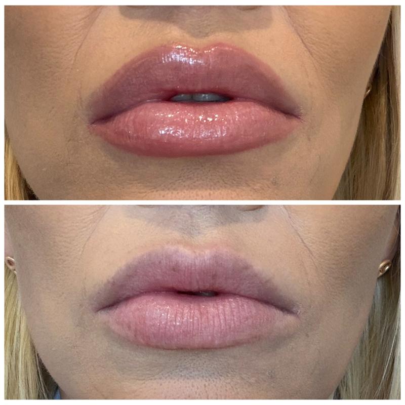 Peptide Lip Shape Contouring Lip Shaper - rhode | Sephora