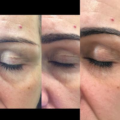 black pine super eye serum