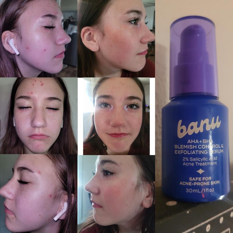review photo