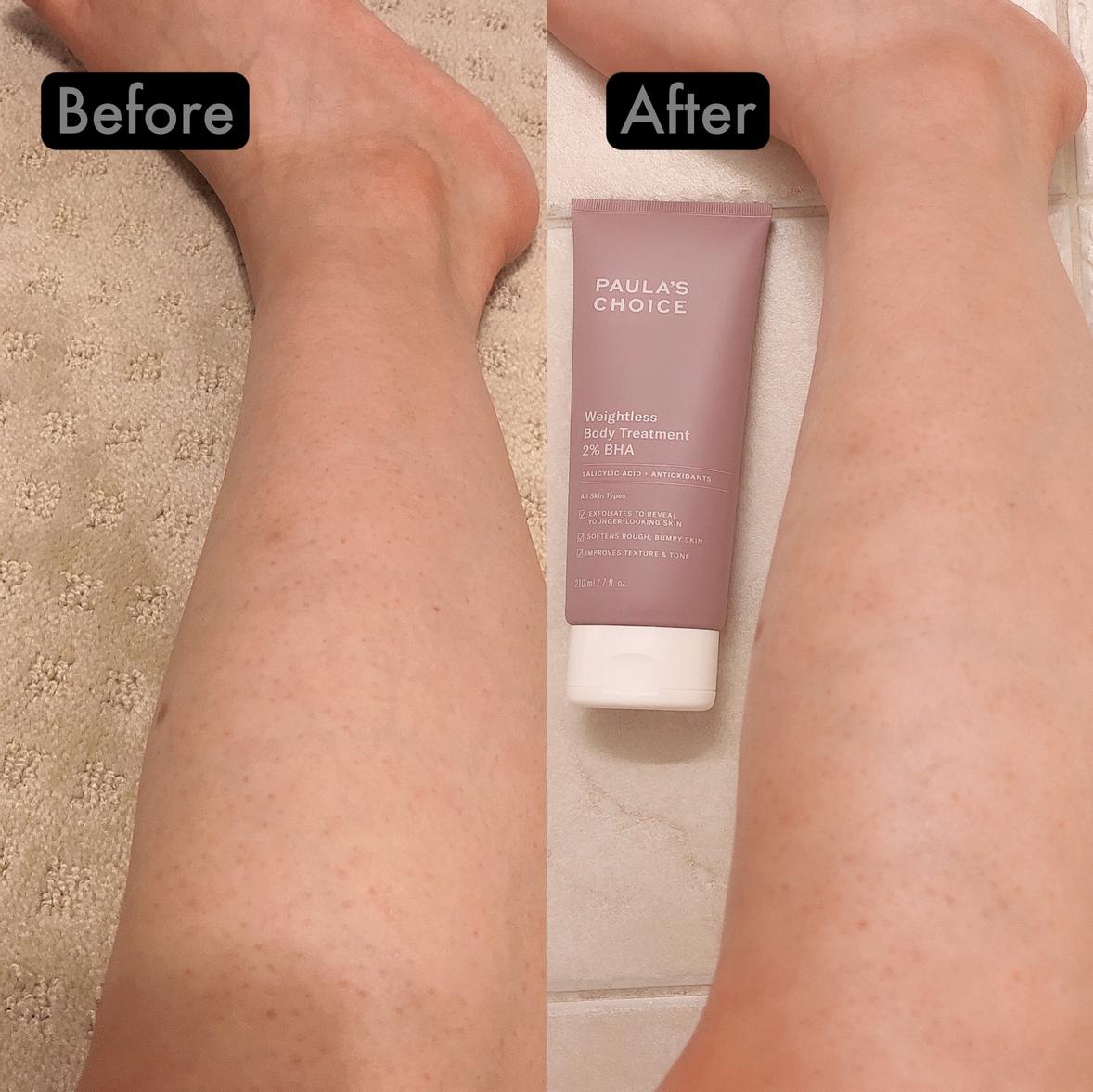 Weightless Body Treatment 2% BHA - Paula's Choice | Sephora