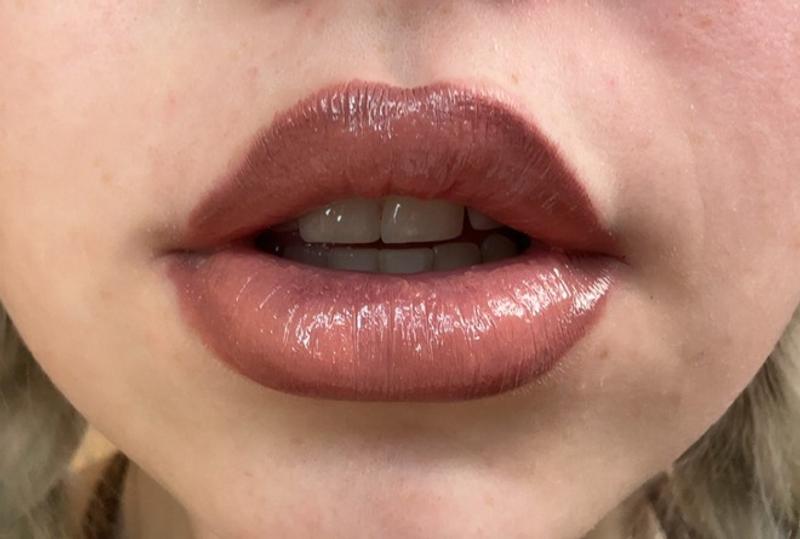 review photo