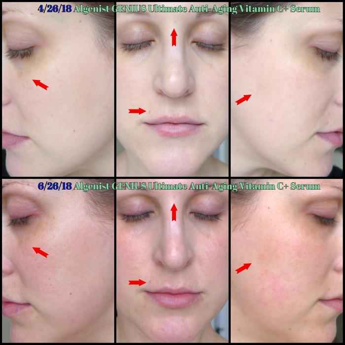 genius vitamin c serum
