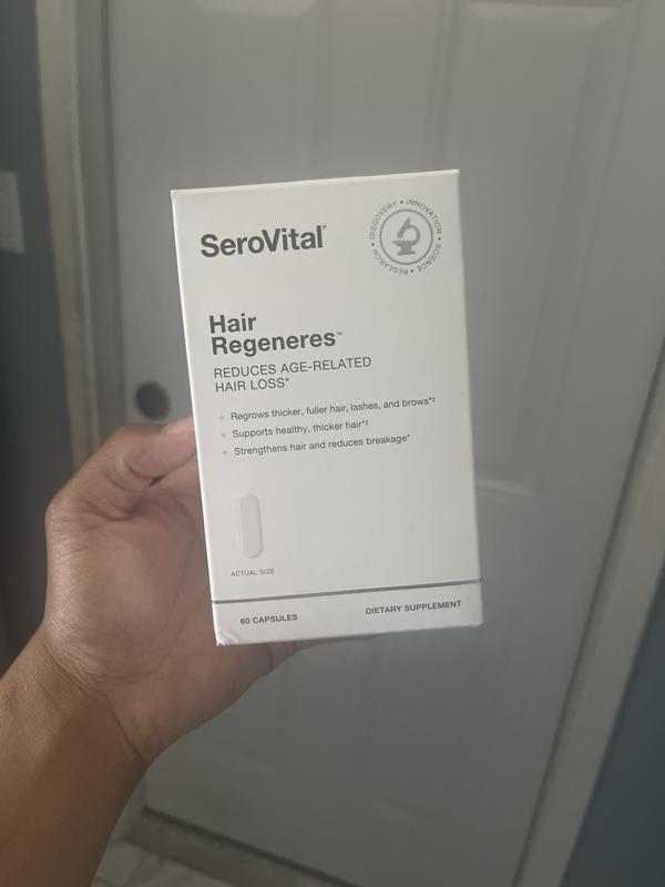 Customer photo for "Love a full head of hair"