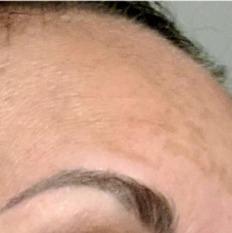 After treatment /before treatment