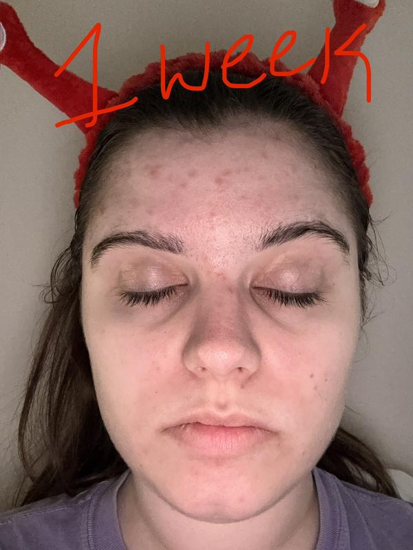 Review Thumbnail Image 2 383552454