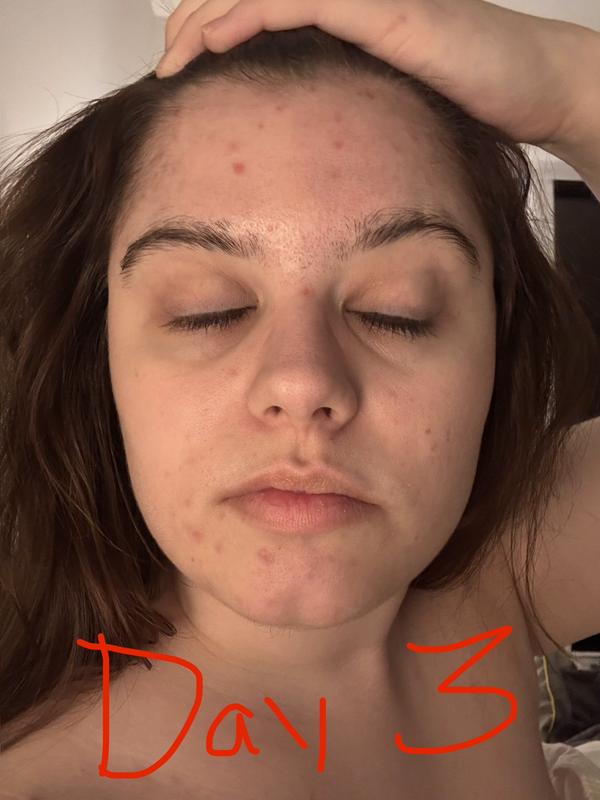 Review Thumbnail Image 1 383552454