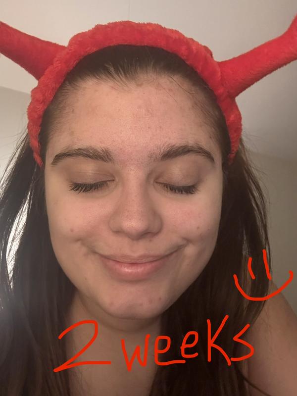 Review Thumbnail Image 3 383552454