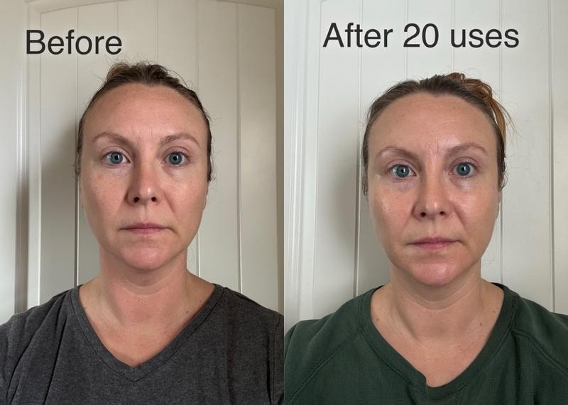 CryoGlow mask at home