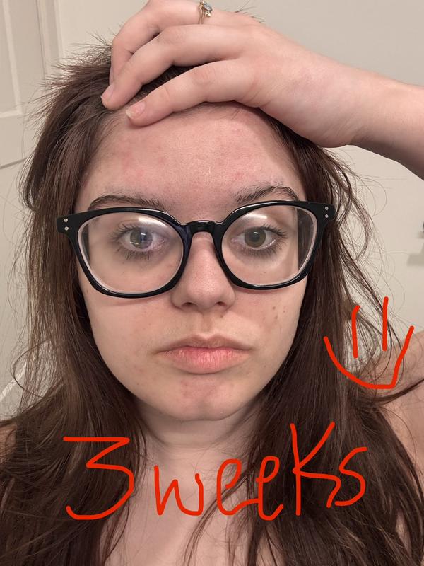 Review Thumbnail Image 4 383552454