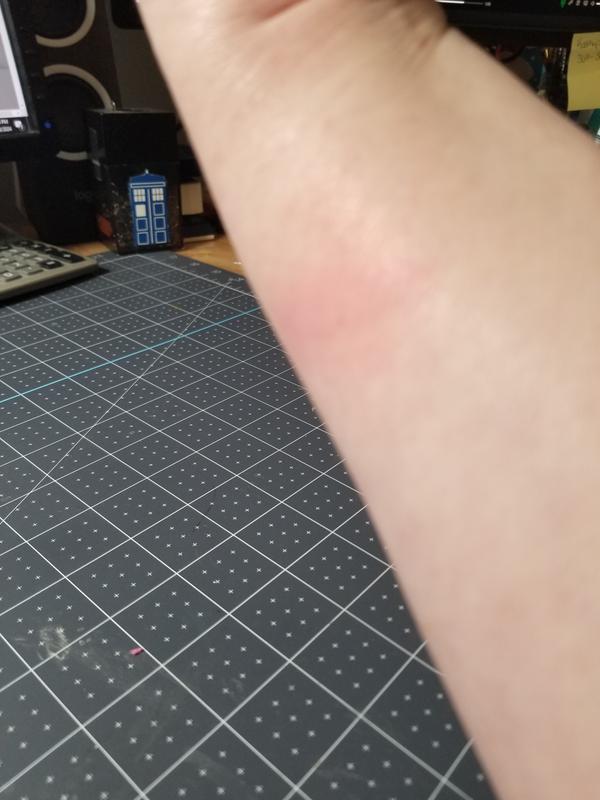 Burned my arm on the pot edge when trying to remove the plate.