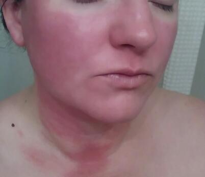 Wtf Coconut Shea Moisture milk mask burn my face. | The Internet's ...