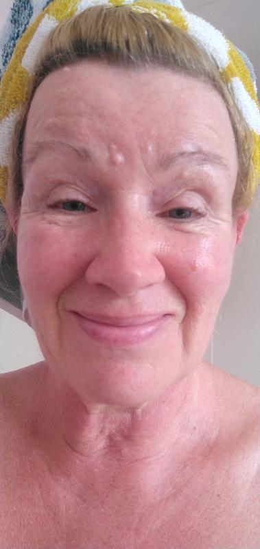 A before photo, deep lines!