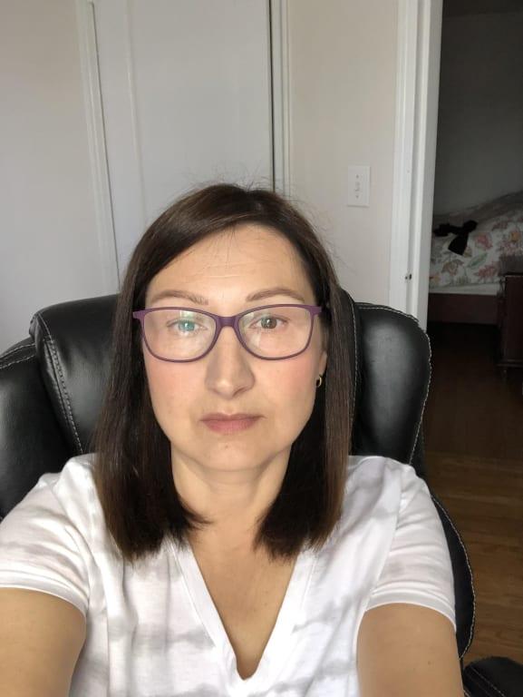 Customer photo for "Best skin moisturizer"