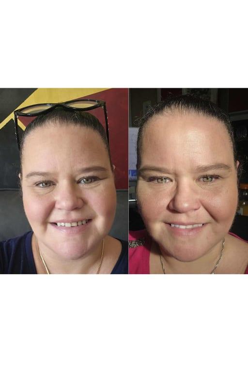 Before and after