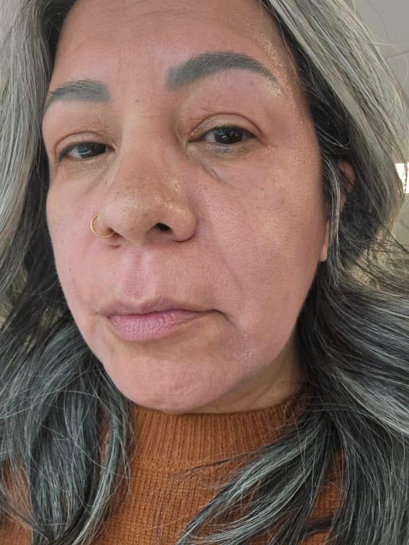 Swollen