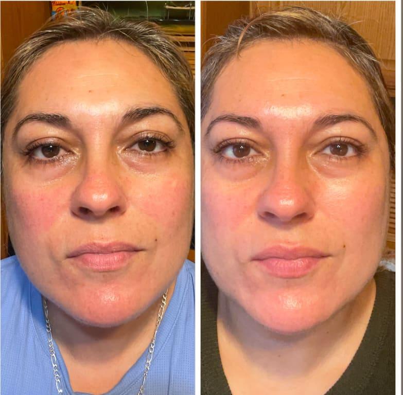 Before and after