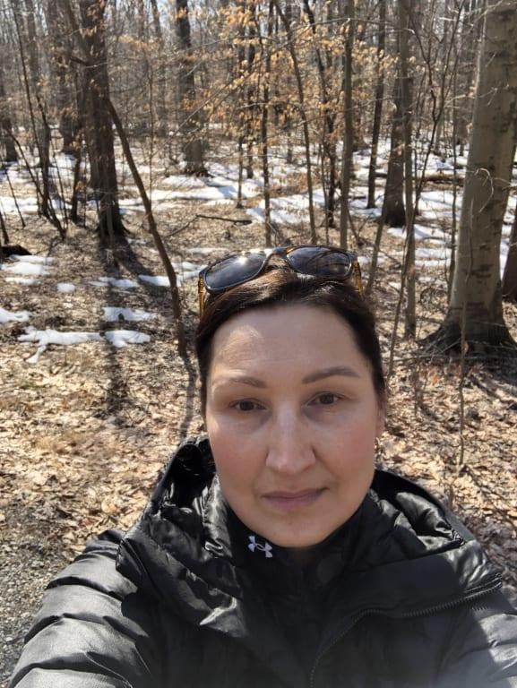 Customer photo for "Best skin moisturizer"