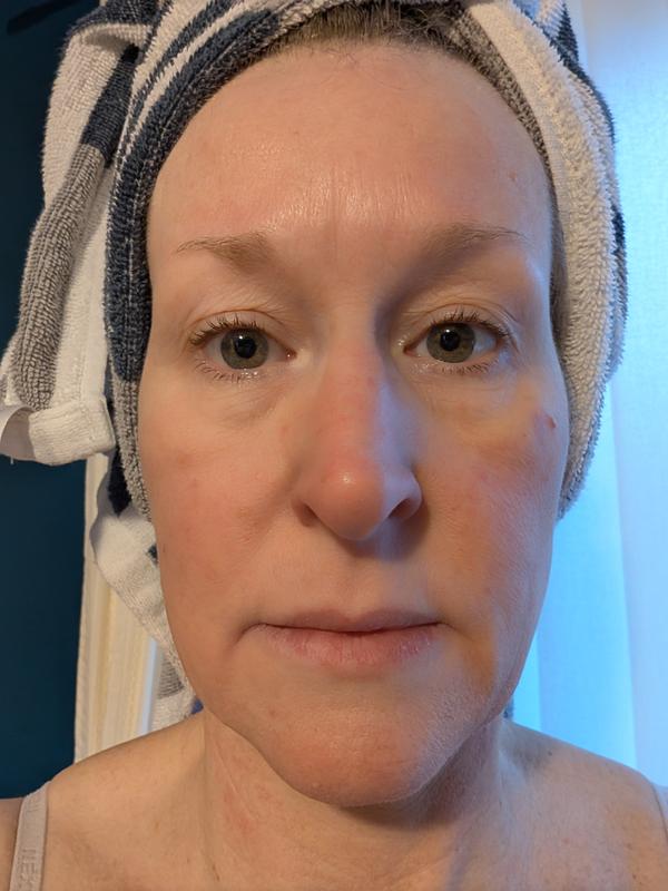 Before first use and after 2 weeks