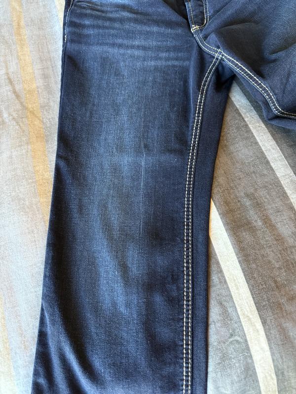 Right leg defect in material