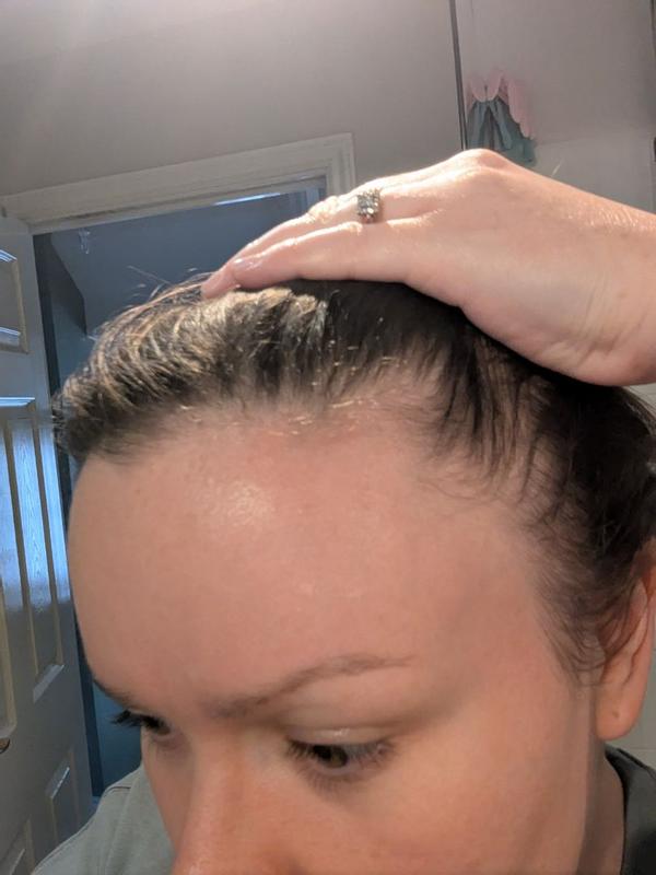 Customer photo for "Best hair serum I've tried"