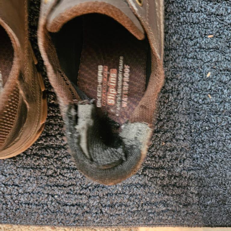 Blowout after tear in right shoe