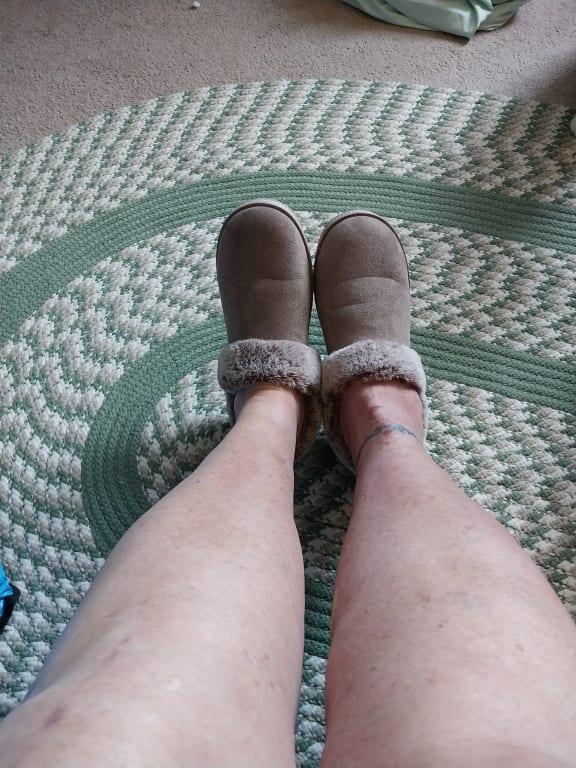 I just had an ankle replacement. Even with all the swelling, they still fit