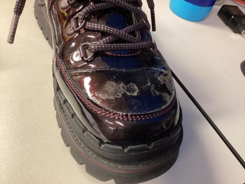 Those round "splotches" are the shiny laminate separating from the shoe.