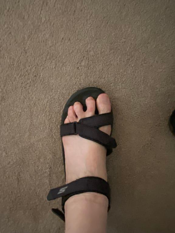 Skecher sandal with great toe over the edge of the sole