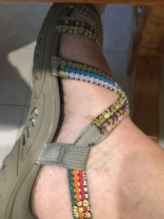 unable to wear only after acouple times