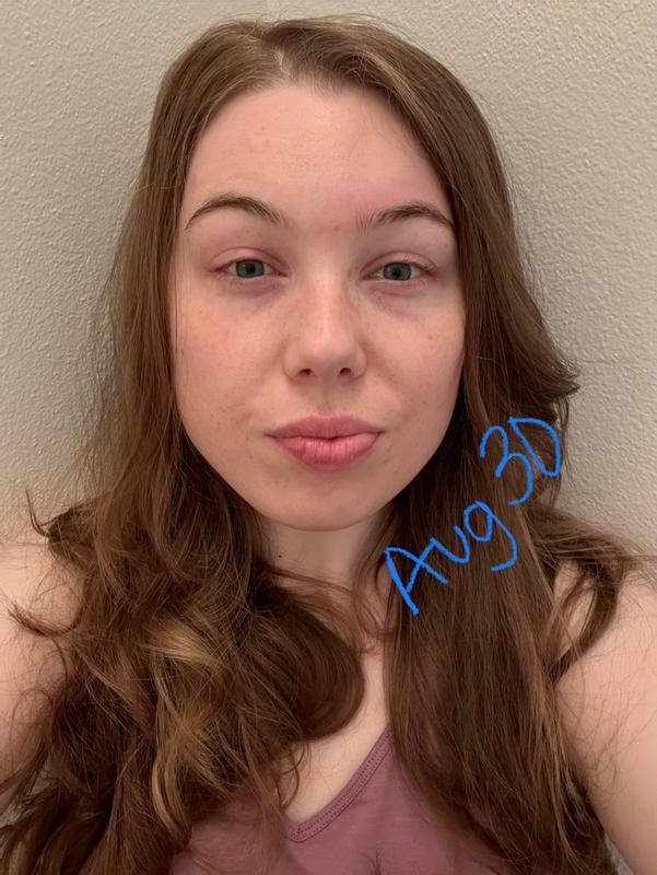 Customer photo for "Did Nothing For My Skin"