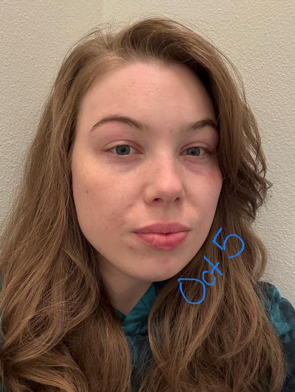 Customer photo for "Did Nothing For My Skin"