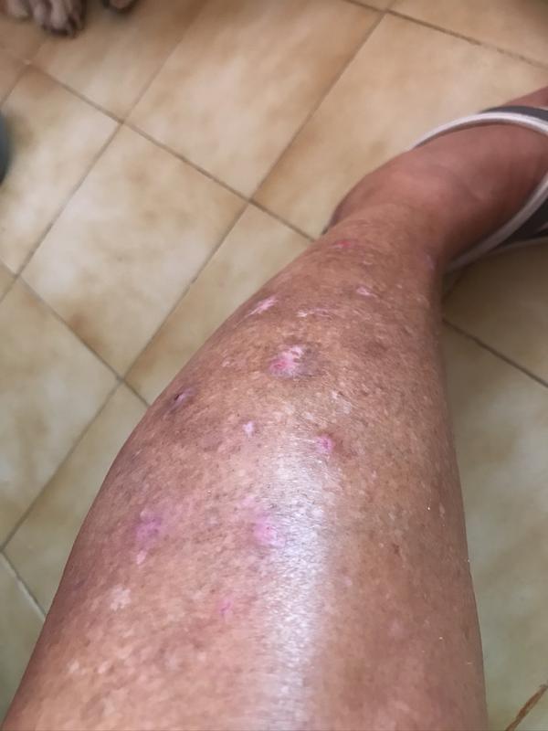 slmd super cortisone