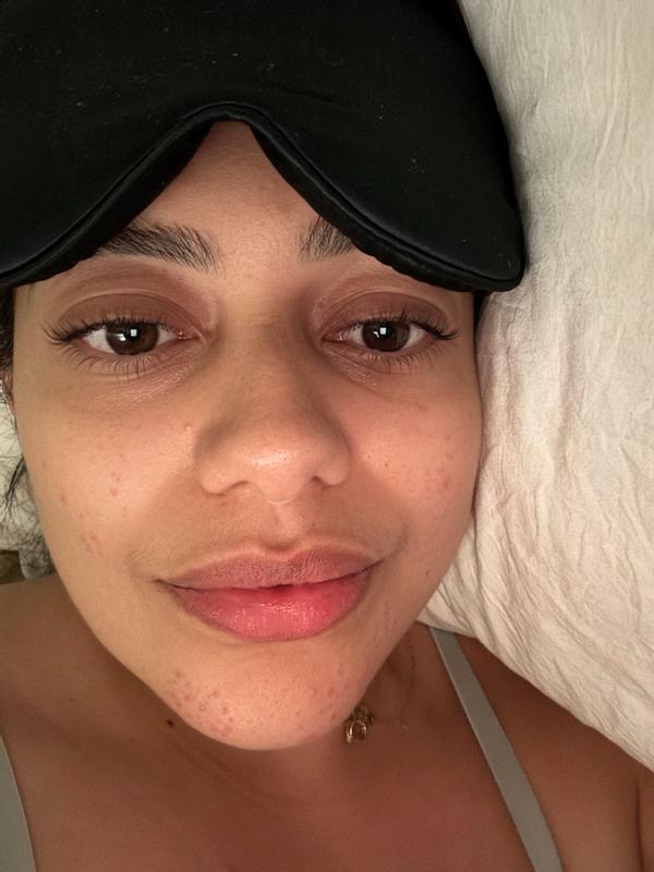 Customer photo for "I can use eye masks again!"