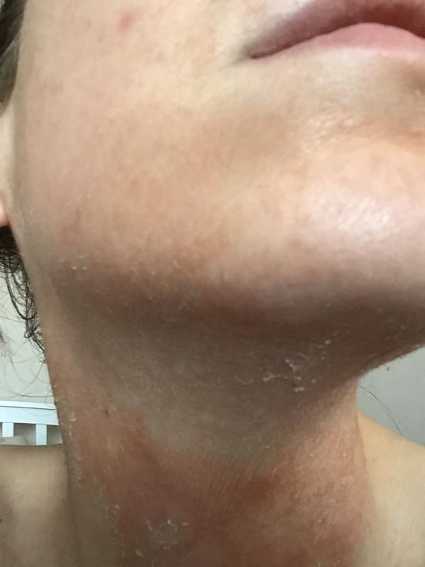 Customer photo for "Great, at first, then the results are awful"
