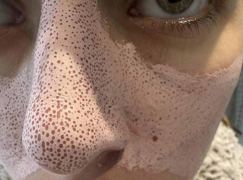 Customer photo for "Visible Results, Immediately!"