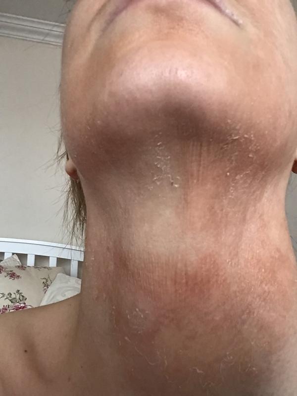 Customer photo for "Great, at first, then the results are awful"