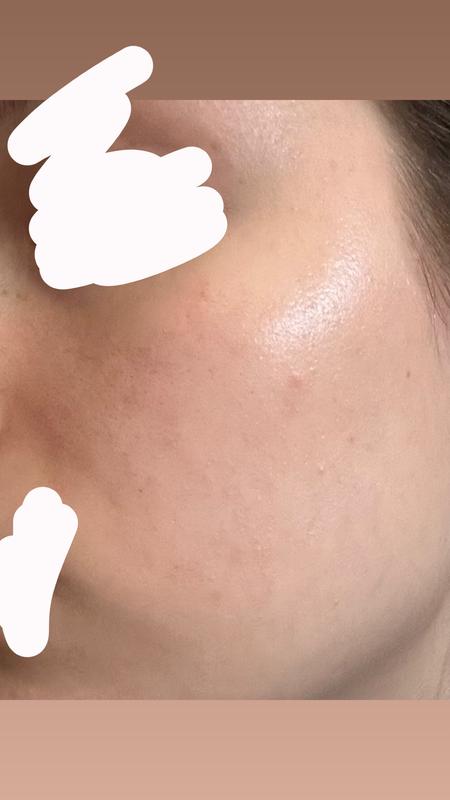 Customer photo for "Amazing product"