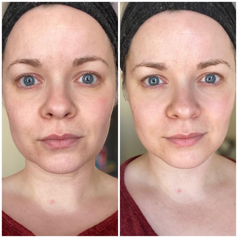 aero advanced skincare infusion system