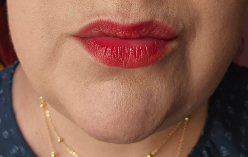 Color is Ruth, this is 2 hrs after application