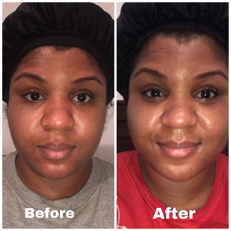 Redness decreased, fresher skin feel