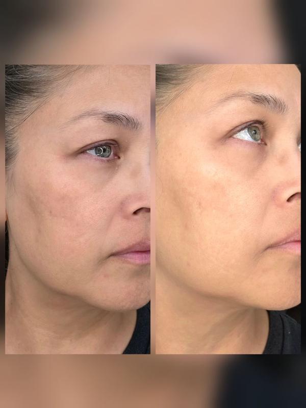 Review Thumbnail Image 0 299889619