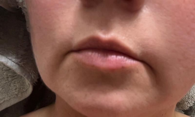 Customer photo for "Great plumper"