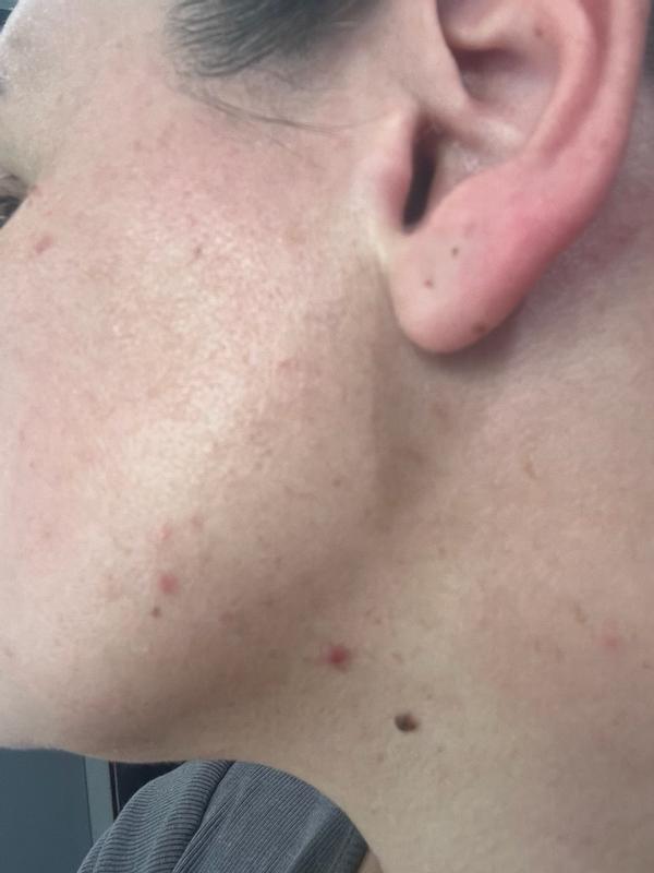 Review Thumbnail Image 4 299849459