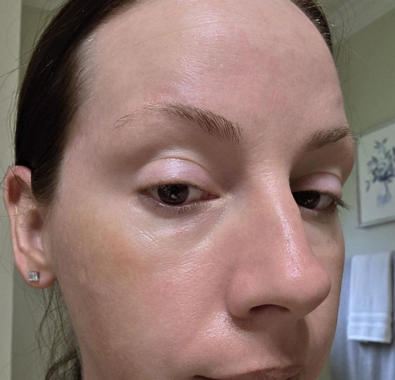Customer photo for "Strivectin eye serum"