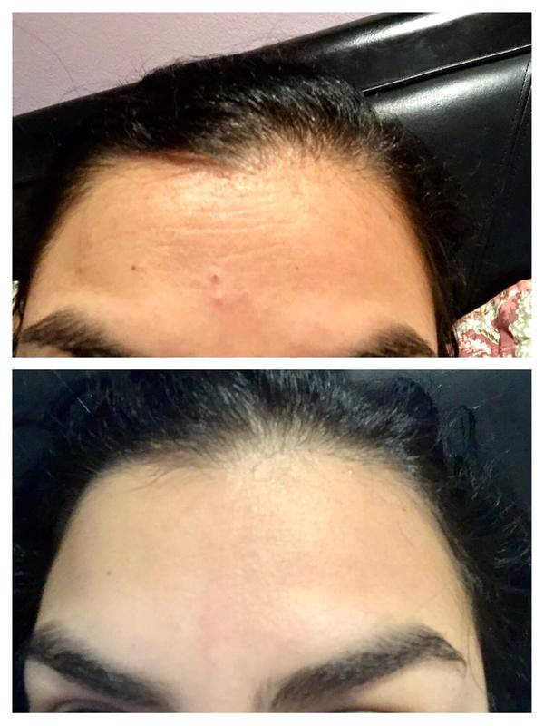 Before on top and after below
