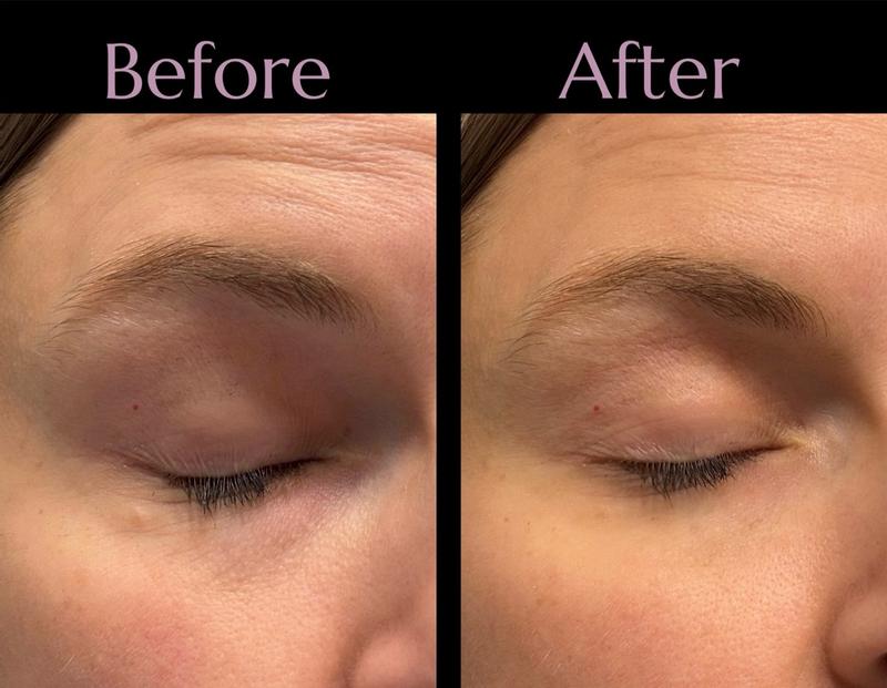 Customer carousel item 3.