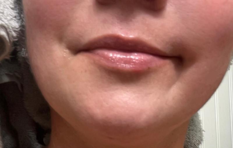 Customer photo for "Great plumper"