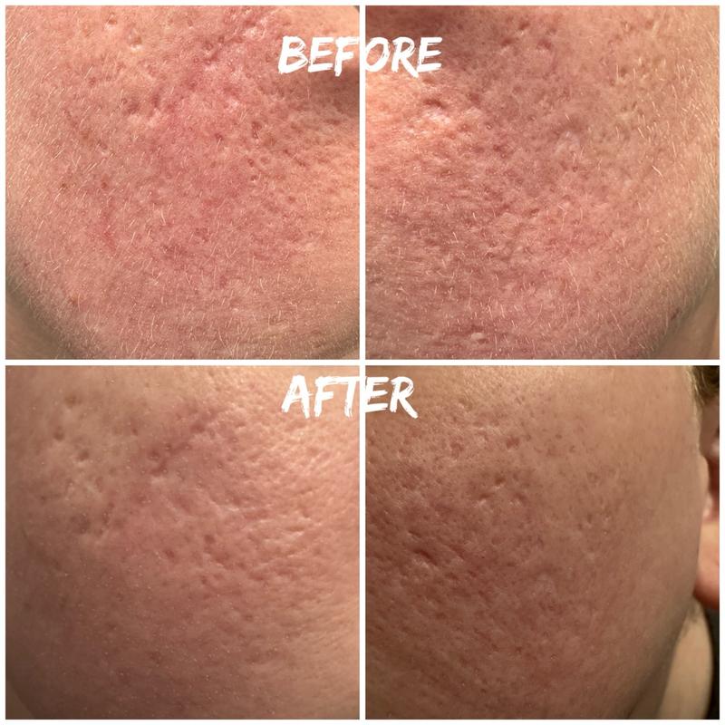 Customer photo for "Smooth hydrated skin"