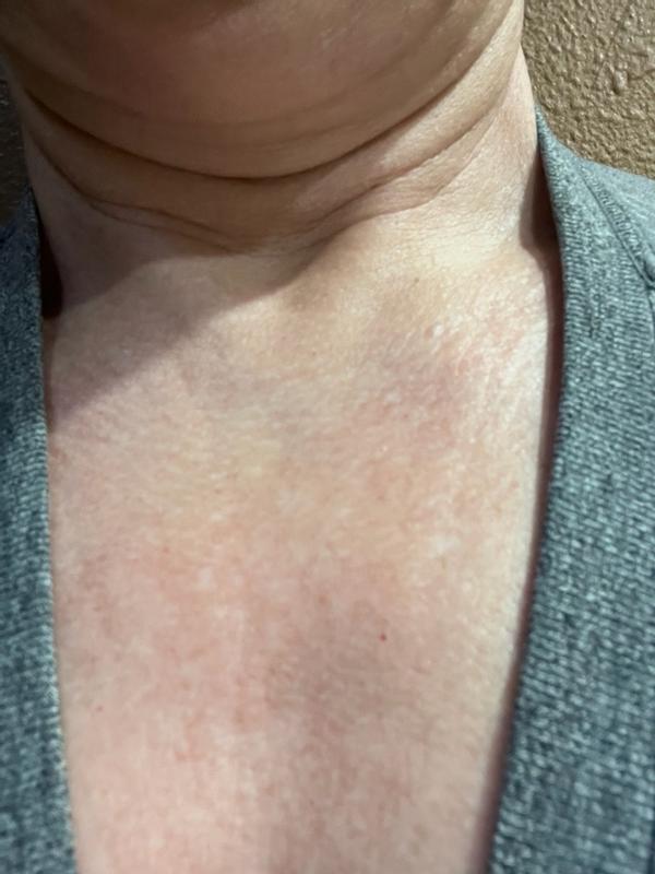 Review Thumbnail Image 3 300311693